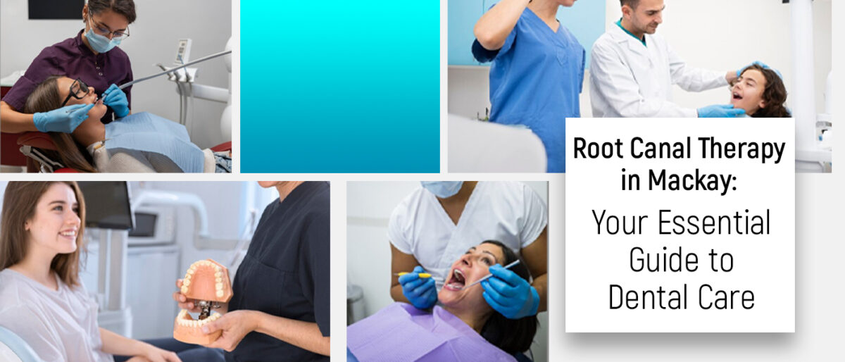 Root Canal Therapy in Mackay: Your Essential Guide to Dental Care