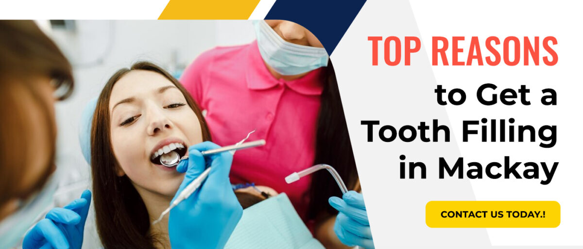 Top Reasons to Get a Tooth Filling in Mackay